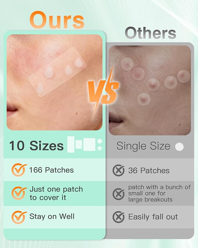 166-Piece Pimple Patch Set