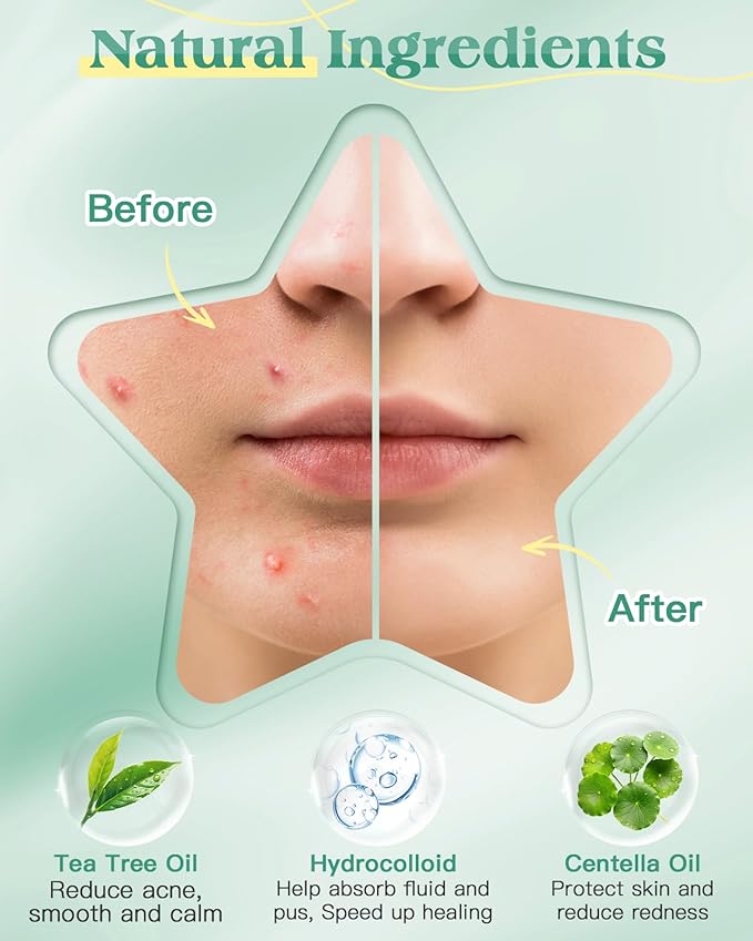 Lullu Pimple Patches (280 PCS, 7 Colors)