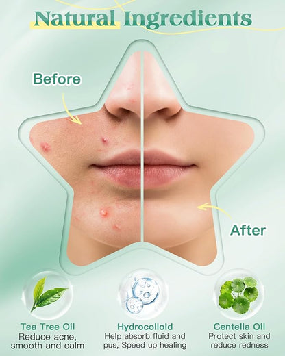 Lullu Pimple Patches (280 PCS, 7 Colors)