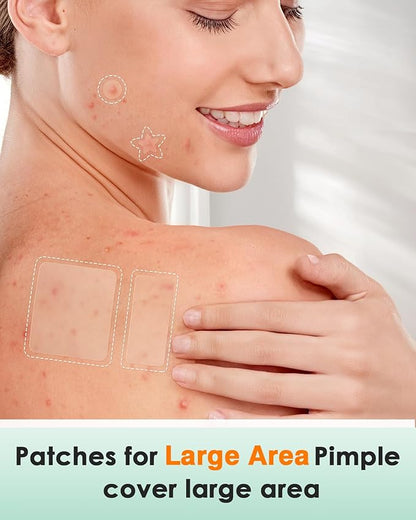 166-Piece Pimple Patch Set