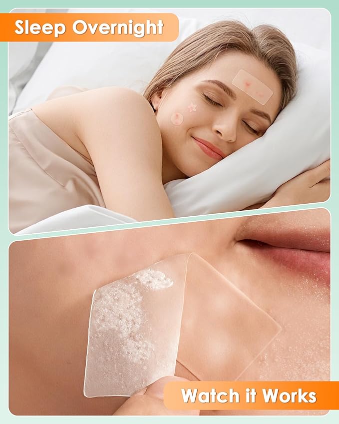 166-Piece Pimple Patch Set